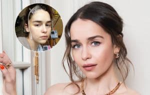 Así luchó Emilia Clarke por su vida tras sufrir problemas en el cerebro cuando filmaba Game of Thrones