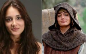 Después de 10 años, famosa actriz aún tiene problemas por una operación estética, ya se hizo 13 cirugías reconstructivas