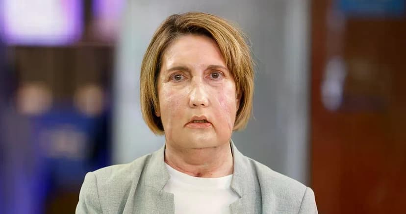 Hospital de España hace primer trasplante de cara del mundo con donante de eutanasia